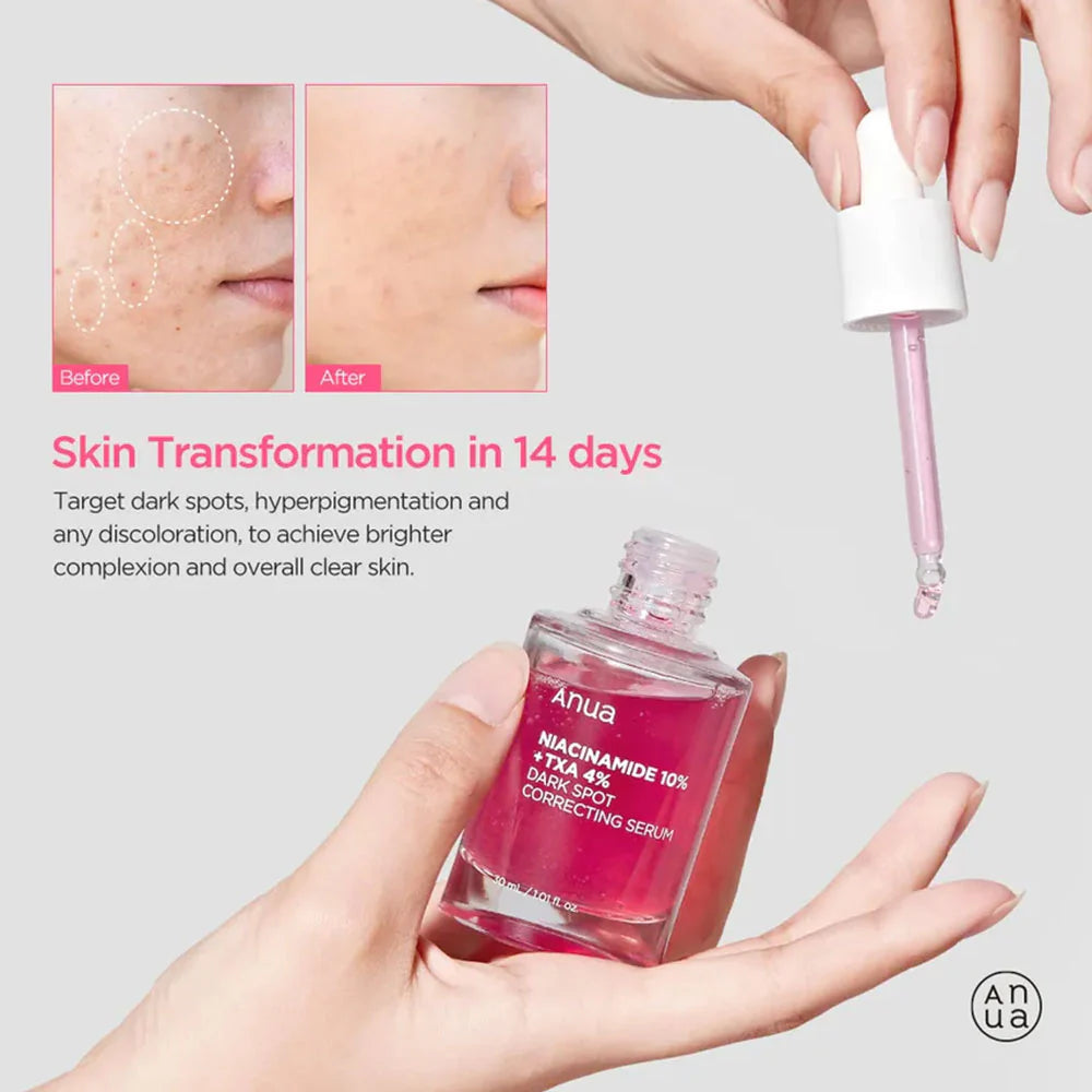 ANUA – Niacinamide 10% + TXA 4% Dark Spot Correcting Serum